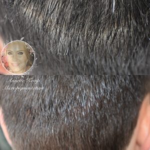 Scalp micropigmentation tattoo