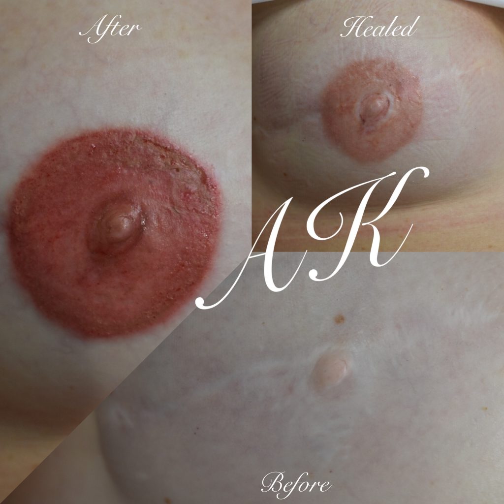 areola tattoo