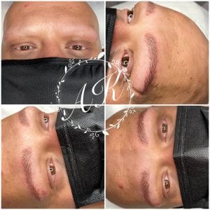 Microblading for male alopeica