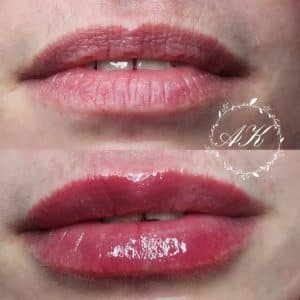 Lip booster