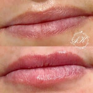 Lip booster