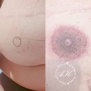 Medical Tattoo